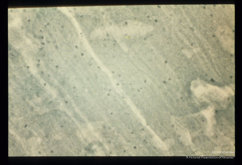 Xeroradiograph of bear muscle showing calcified cysts as small dense spots.