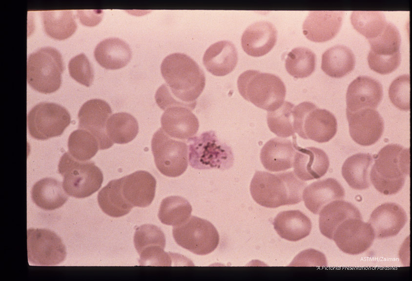 The development of male sexual cells from gametocyte to sperm cells (exflagellation) is shown in this series.