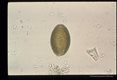Egg in stool of Viet Namese officer.