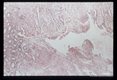 Best carmine stained section of rectum.