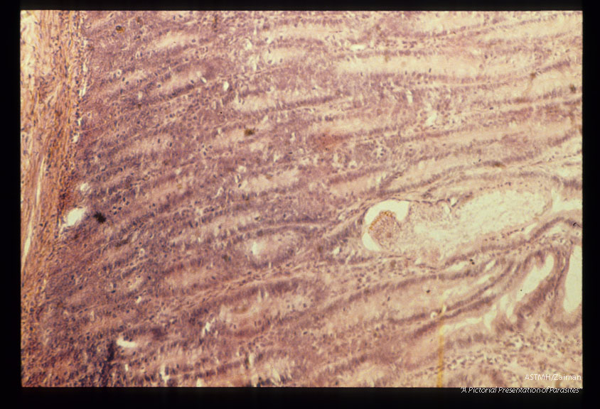 Section through adult in dog intestine.