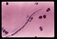Posterior end of another microfilaria.