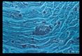 Hematoxylin-eosin stained (phase microscopy) section of infected myocardium.