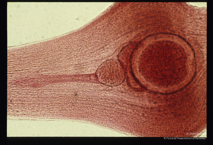 "Gravid proglottid, " with the uterus emptied.