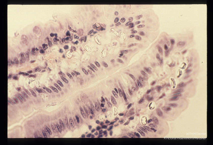 Sporocysts in opossum small intestine.