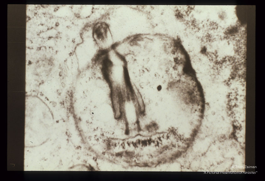 A single parasite is present within a spleen cell. Flagellum and associated structures are well seen.