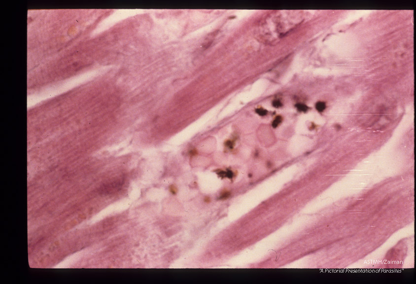 Parasites in cardiac capillary.