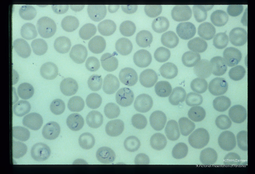 Multiple blood smears from experimental animals infected with material derived from human case.