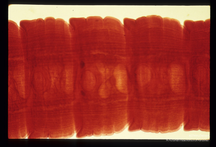 Segments from human case.