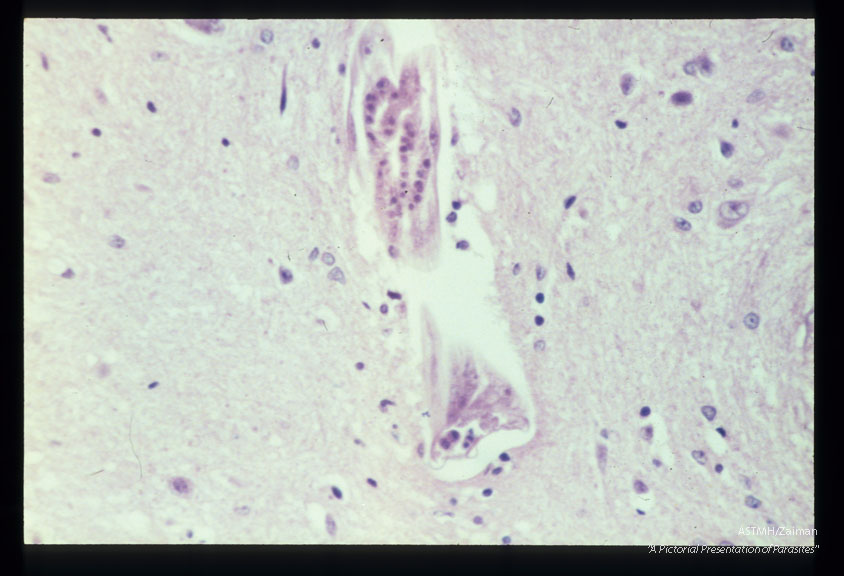 Longitudinal and cross-section of larvae in the spinal cord.