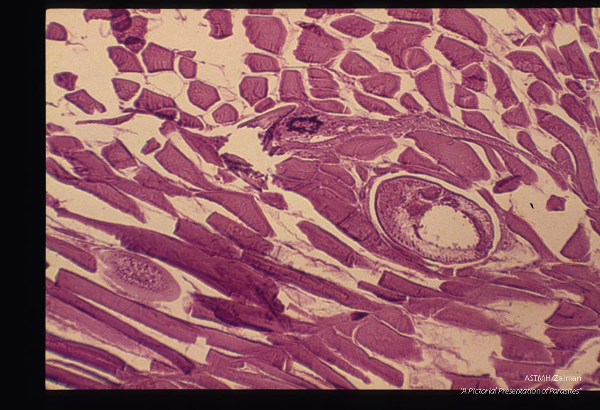 Metacercaria in fish muscle.