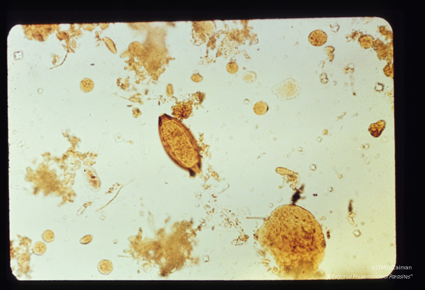 Egg in stool, iodine stained.