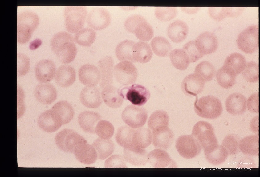 The development of male sexual cells from gametocyte to sperm cells (exflagellation) is shown in this series.