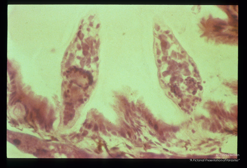 Miracidia penetrating the esophageal wall of the snail intermediate host, Lymnaea catascopium.
