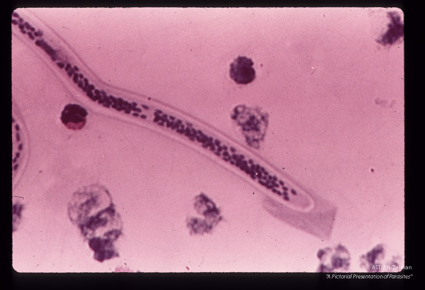 Anterior end of microfilaria in blood film.