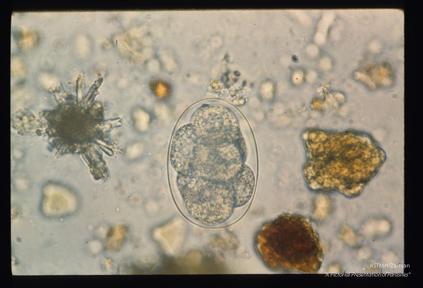 Sequence showing development of larva in egg.