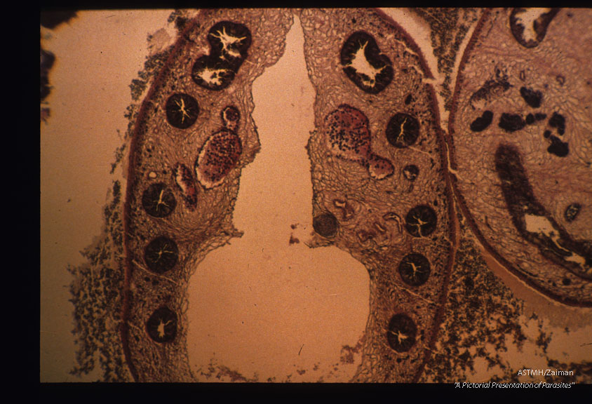 Sections through adalts in Rattus norvegicus lung.