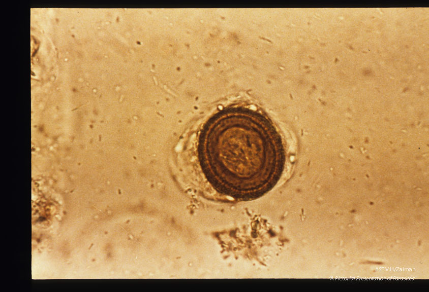 Egg in stool. Iodine stained.