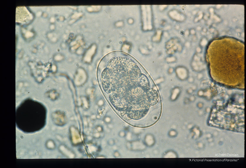 Sequence showing development of larva in egg.