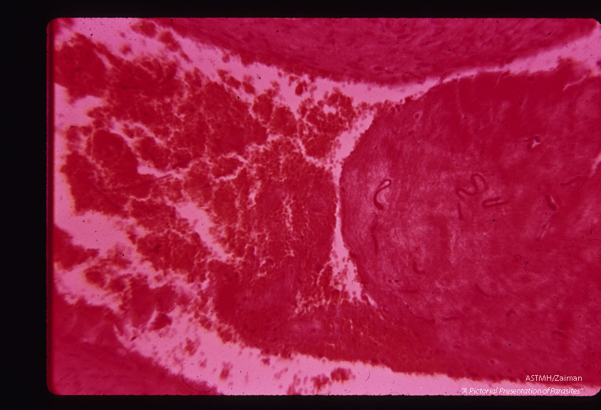 Larvae in pulmonary vein.