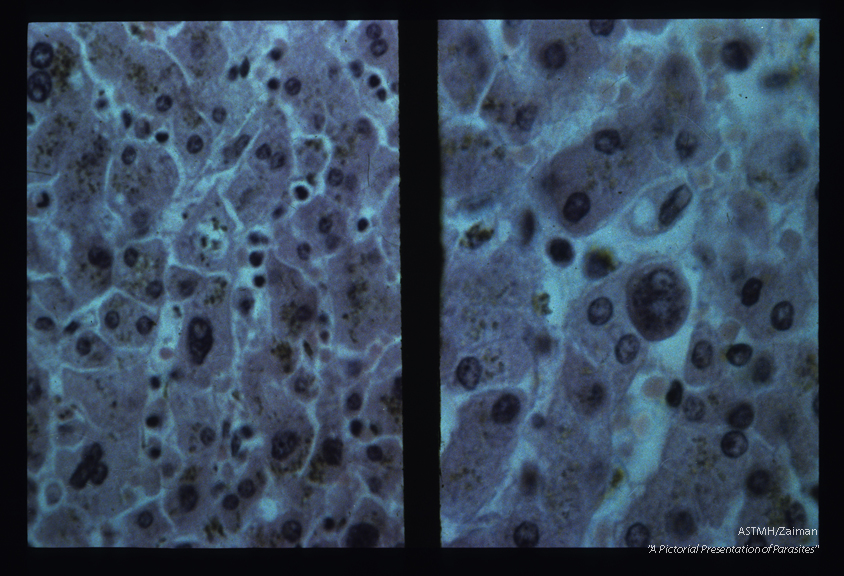 Human liver- High dry and oil immersion objectives.