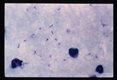 Thick smear showing rings only.