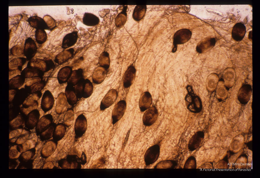 Various magnifications of calcified cysts in masseter muscle of rat xeroradiographed in slide 1602.