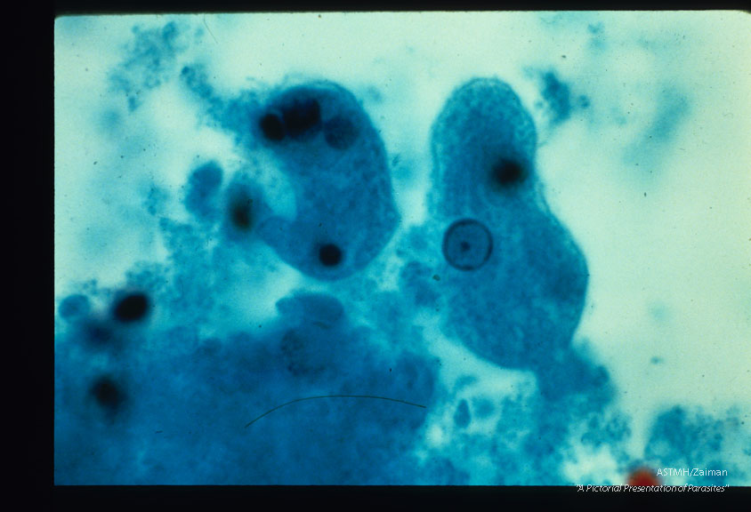 Trophozoites with ingested blood cells.