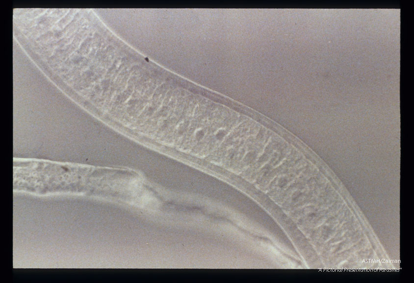 Stichosome region of a muscle larva.