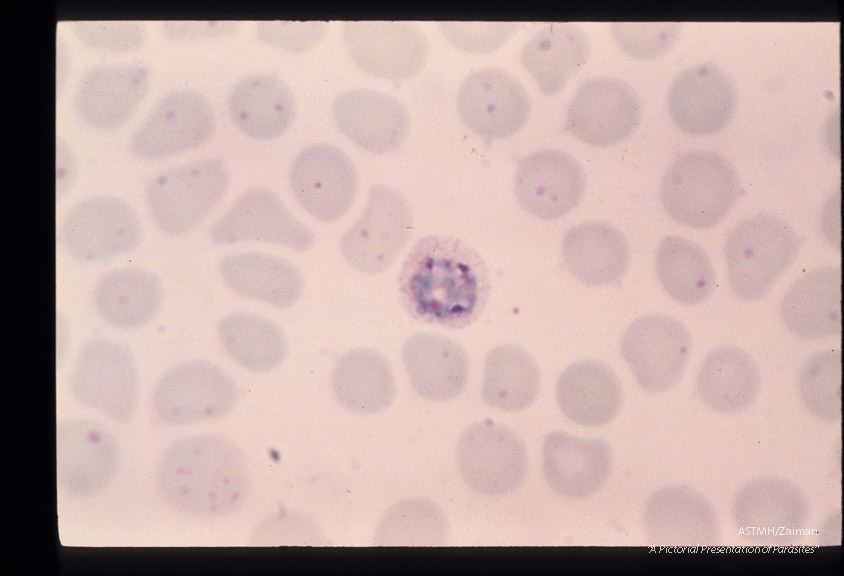 Schizogony from binucleate through multinucleate stages is demonstrated