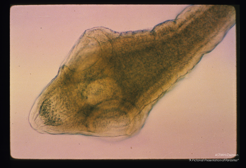 Scolex. Three of the four suckers and the retracted armed rostellum can be seen. The hooks are remarkably small in size.