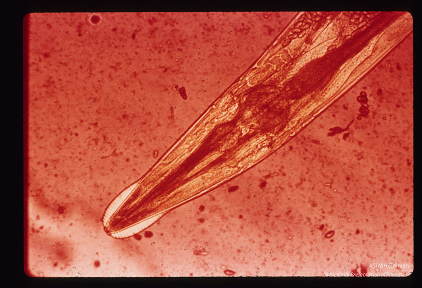 Anterior portion of male showing cervical alae outlined in iodine stained stool emulsion.