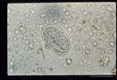Sequence showing development of larva in egg.