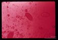 Egg in stool, iodine stain.
