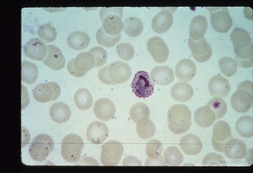 Growing trophozoites.