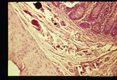 Eggs in armadillo bowel.