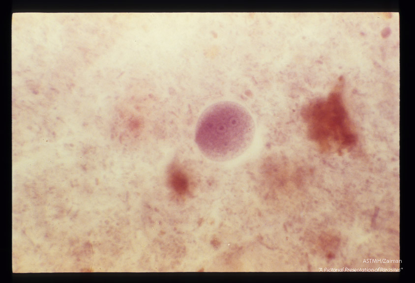 Cysts in stool, showing various numbers of nuclei, hematoxylin stain.