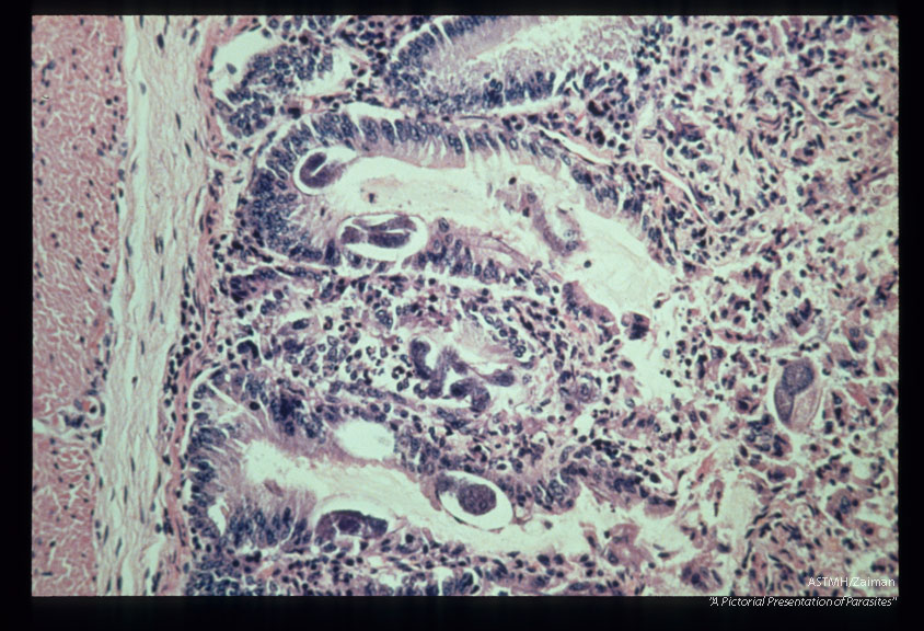 Eggs and larvae in intraepithelial tunnels of duodenal mucosa of Erythrocebus patas.