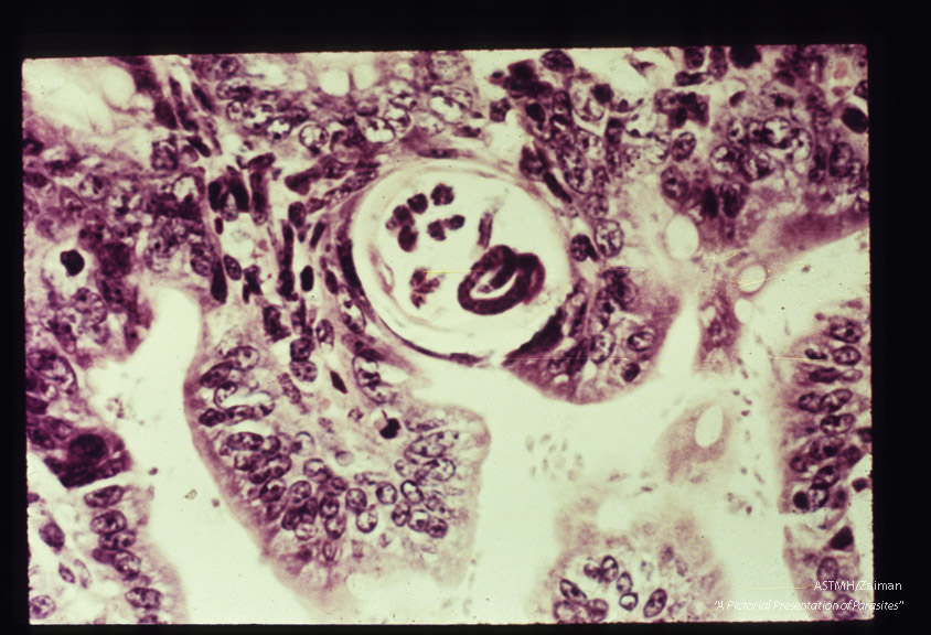 Larvae within an adult female embedded in a mouse intestine. (H&E).