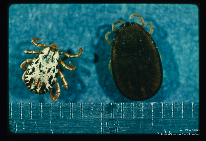 Dorsal view. A brightly decorated scutum is present on the hard tick (Dermacentor) but not on soft Argas.