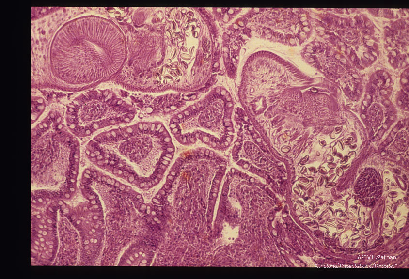 Adult in intestinal wall.