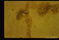 Unstained whole mount of an intestinal biopsy.