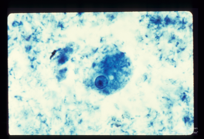 Trophozoite. Iron hematoxylin stain. A karyosome (endosome) within the nucleus is eccentric and large.