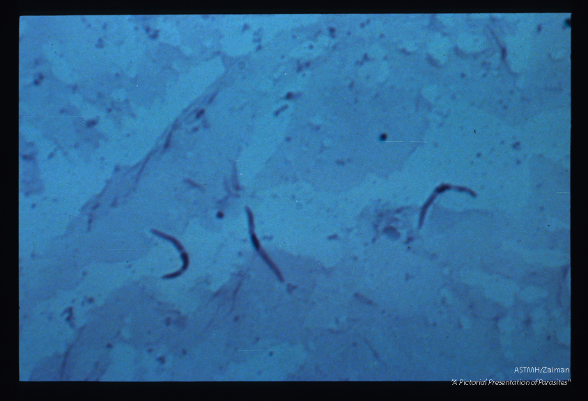 Sporozoites from mosquito.