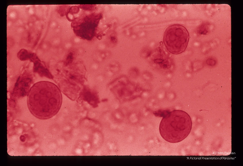 Iodine stained cysts in stool showing different numbers of nuclei.