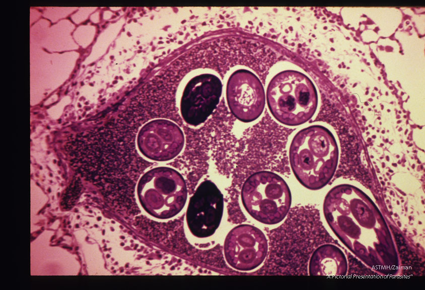 Male and female adults in a pulmonary artery of a Mongolian gerbil.