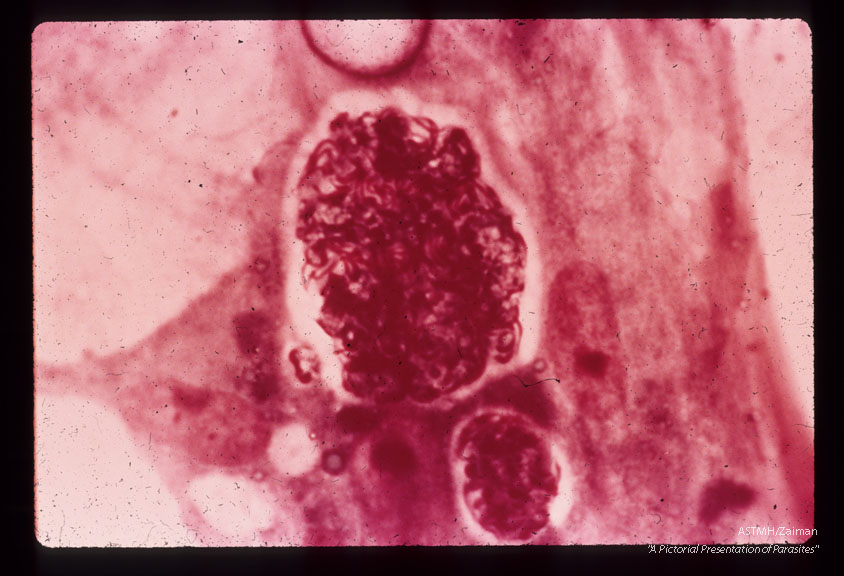 Mature microgametocytes containing many microgametes. Giemsa stain. (216 hr).