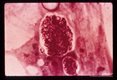 Mature microgametocytes containing many microgametes. Giemsa stain. (216 hr).