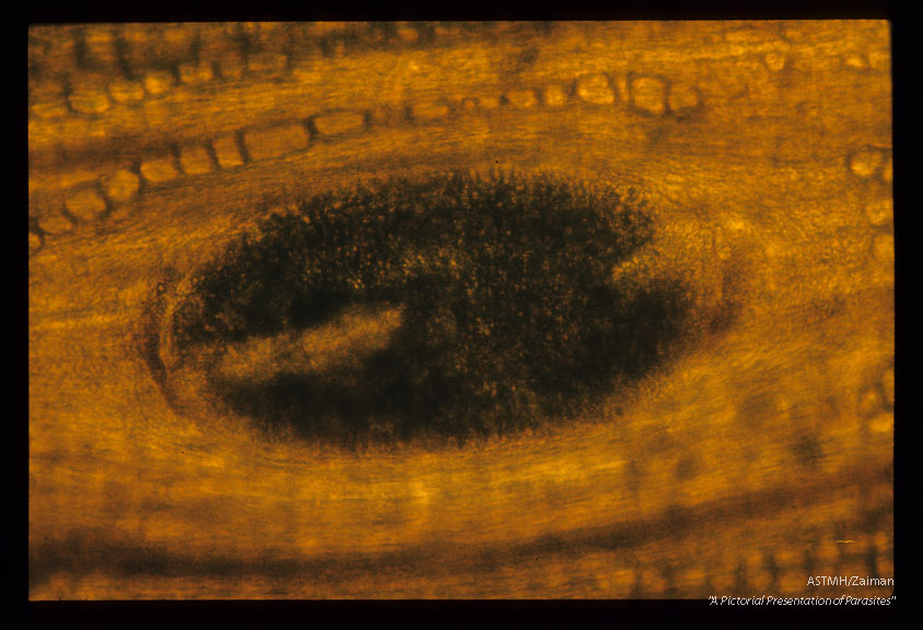 Whole mounts of stained 8 day old worms in the diaphragm of Viverricula indica.