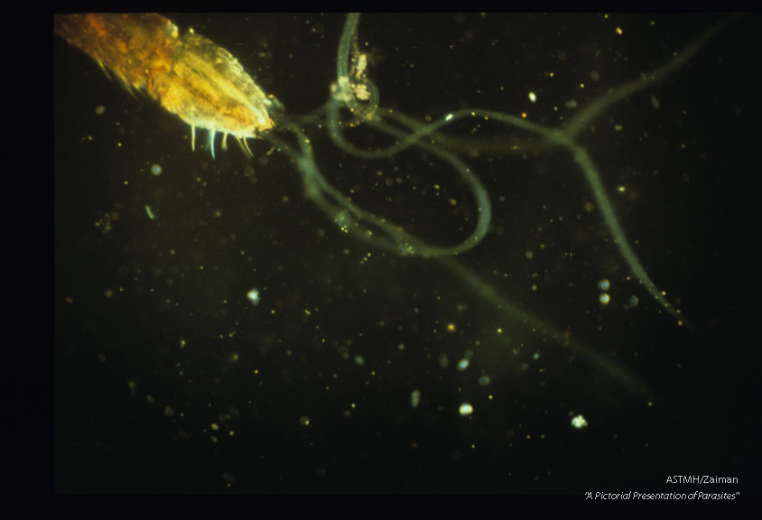 Infectious filaria emerging from the mouth parts of a mosquito (dark-field).